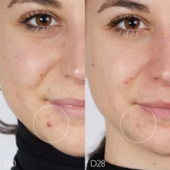 CAUDALIE Vinopure Serum Gegen Unreinheiten 30 Ml -Molton Brown Verkaufs-Shop 1404768 CAUDALIE Vinopure Serum gegen Unreinheiten 30 ml.dca0c6d3